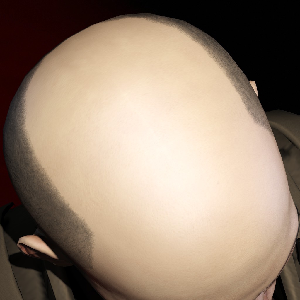 Shaven Head