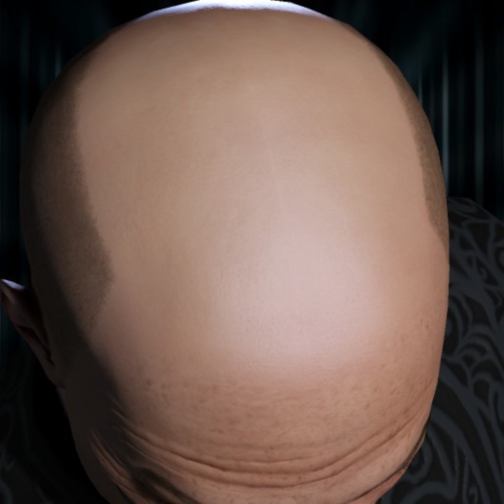 Rhed 5