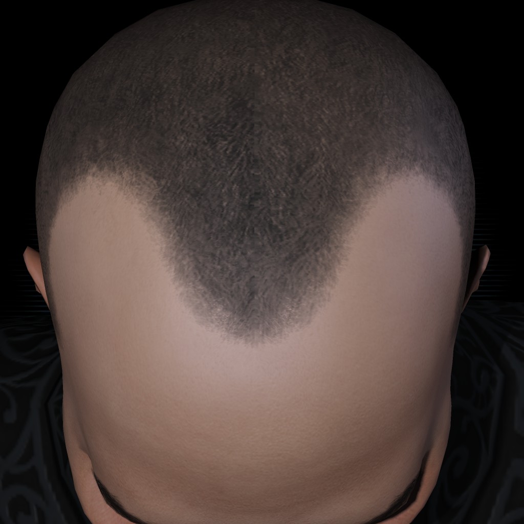 Akom J